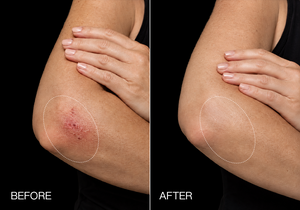 Supports Skin Repair in 2 Weeks.