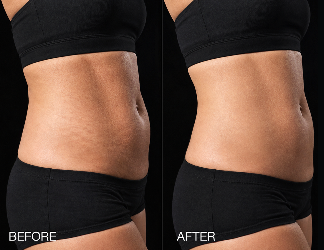 Supports smoother-looking, more even-toned skin.