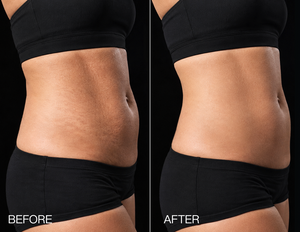 Supports smoother-looking, more even-toned skin.