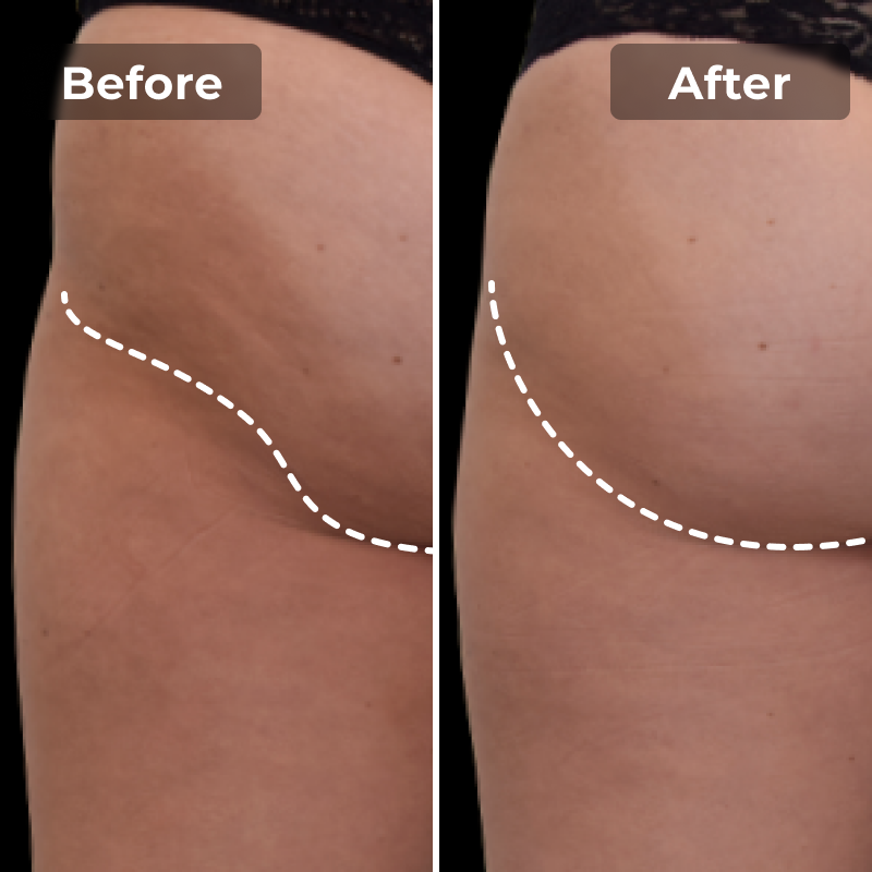 LUMIEMS EMS Toning Shorts My Store