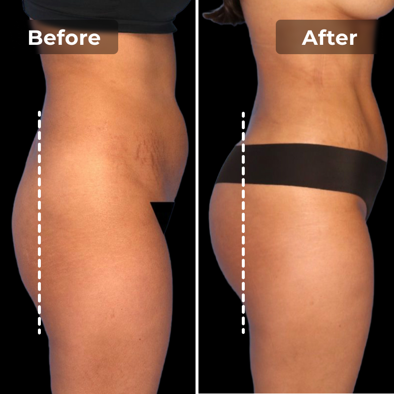 LUMIEMS EMS Toning Shorts My Store