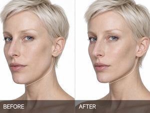 Noticed more defined, sculpted-looking facial contours after 3–4 weeks.*