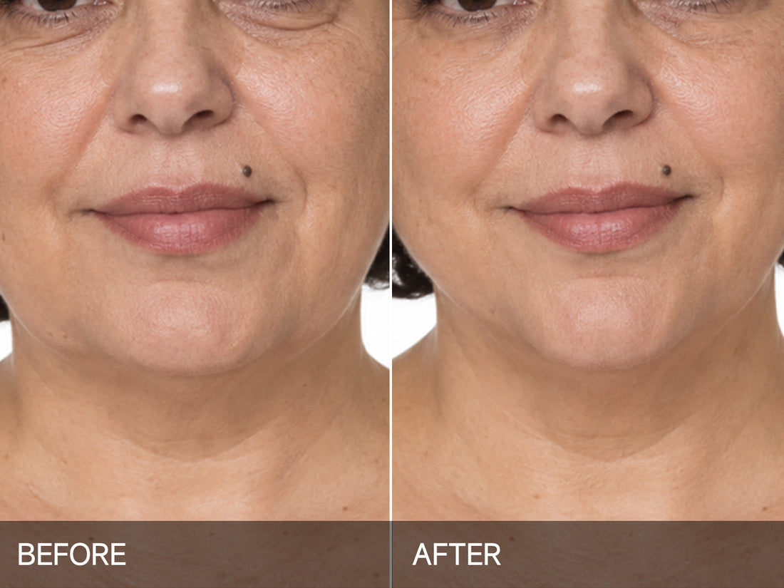 Saw firmer-looking skin after 2–3 weeks.*