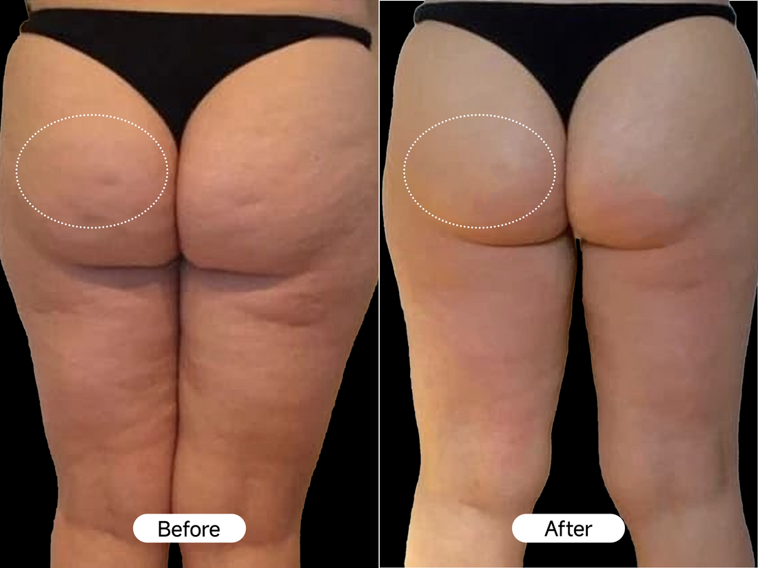 noticed smoother-looking skin and improved texture in 21 days.